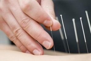 A utilização do Dry Needling por fisioterapeutas